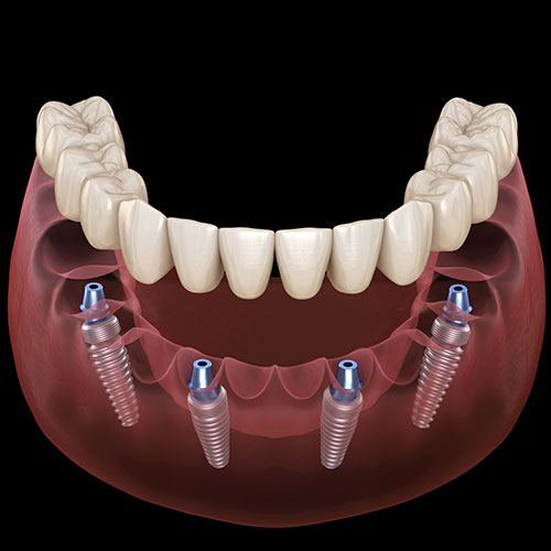 Stony Plain Dental