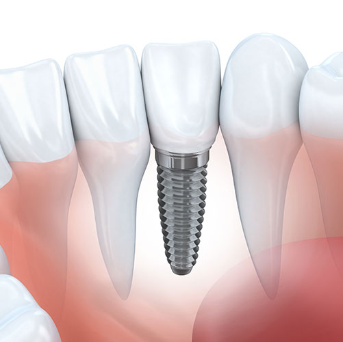 Stony Plain Dental