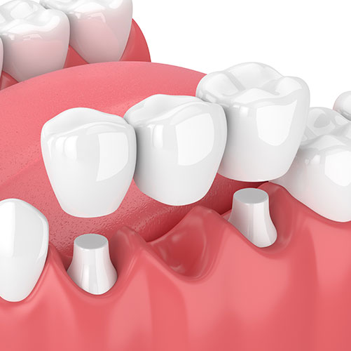 Stony Plain Dental